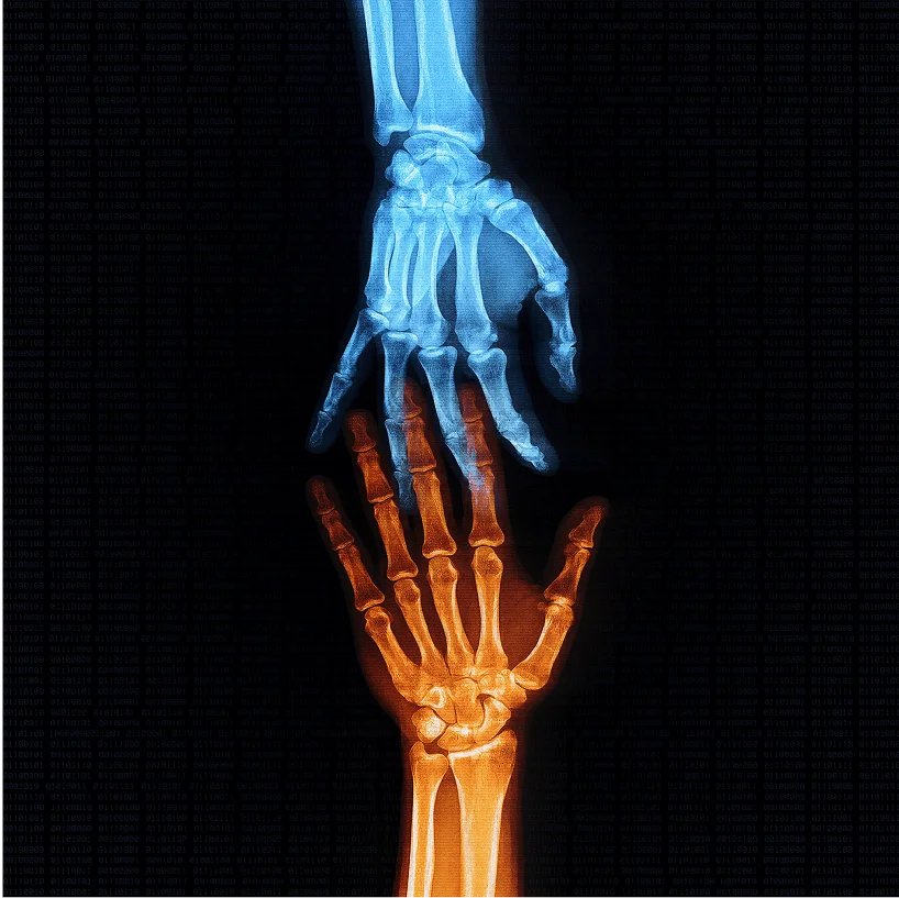 Variations cover